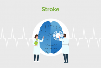 Stroke Management